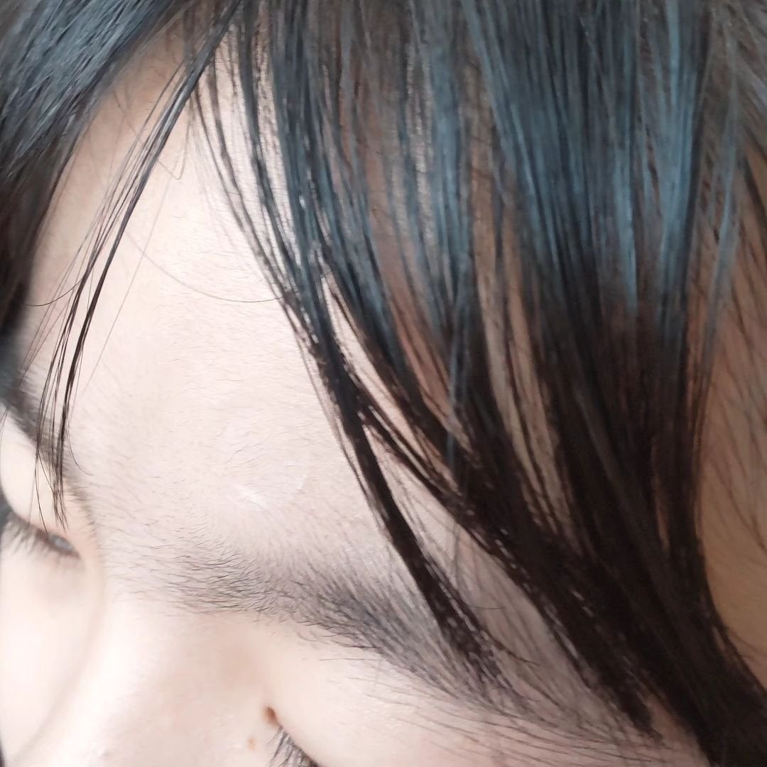 極薄透明パッチ nikipa!/金冠堂/にきびパッチを使ったクチコミ(5枚目)