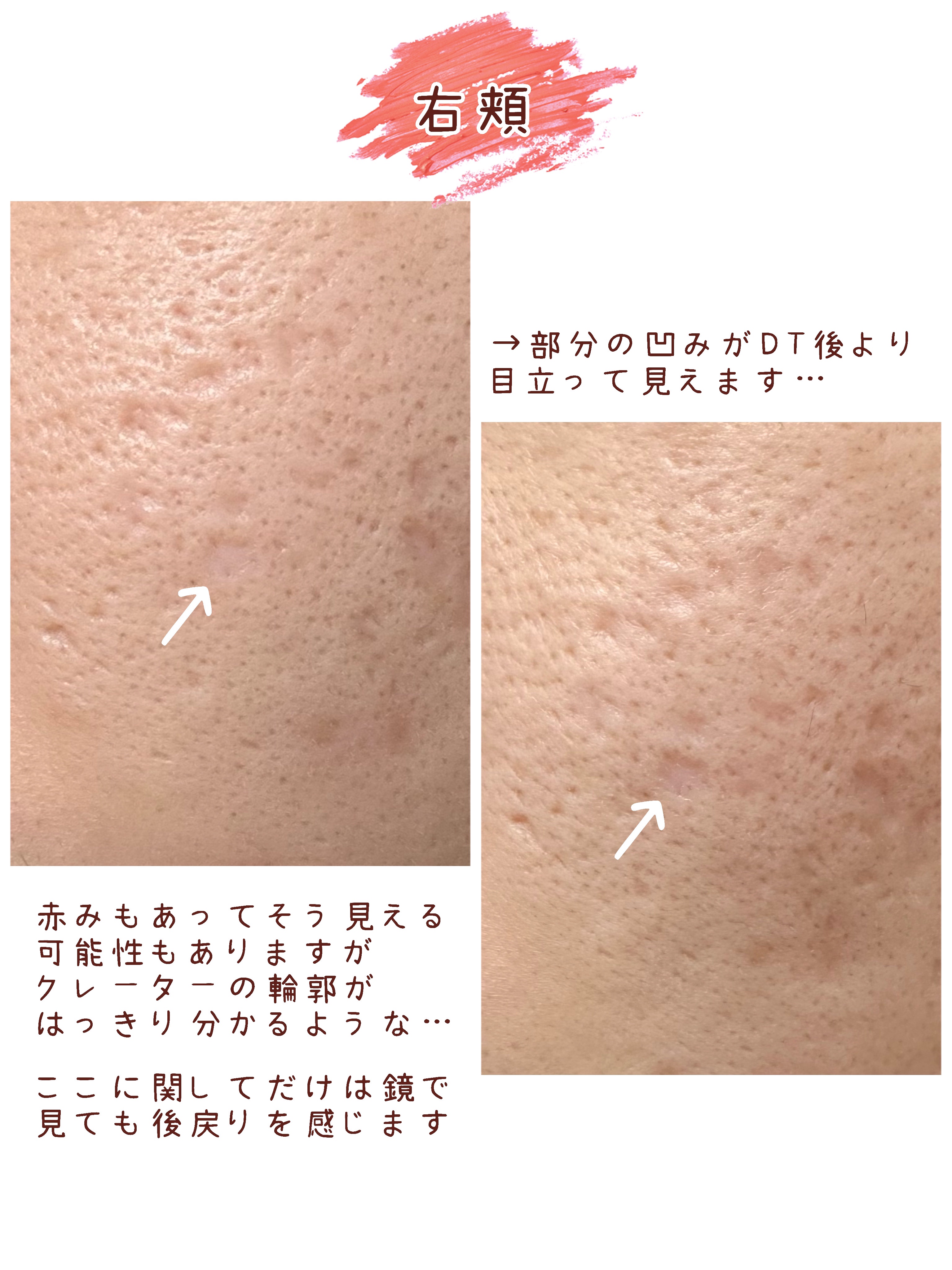 を使ったクチコミ（3枚目）