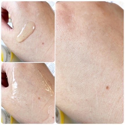 ユズナイアシンアンチブレミッシュセラム/SOME BY MI/美容液を使ったクチコミ(5枚目)