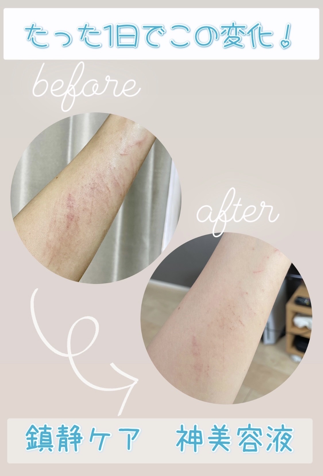 ボタニカルハニー 植物のミッドナイトデュウ/VECUA Honey/美容液を使ったクチコミ（1枚目）