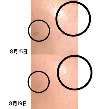 ビタホワイトニングシナジーC.E.F.アンプル/Celladix/美容液を使ったクチコミ(3枚目)