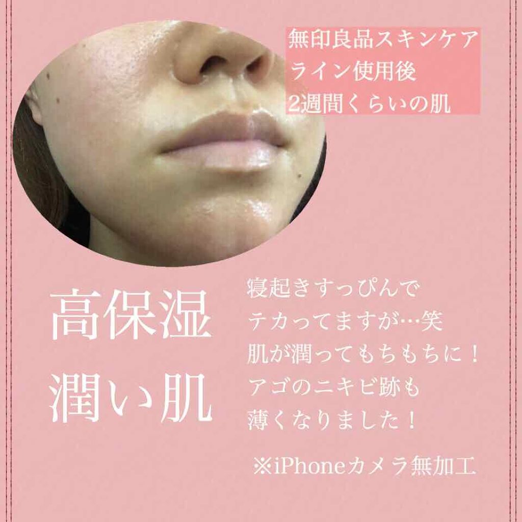 敏感肌用薬用美白美容液/無印良品/美容液を使ったクチコミ（2枚目）