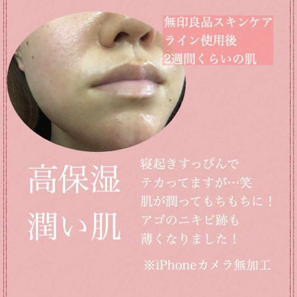 敏感肌用薬用美白美容液/無印良品/美容液を使ったクチコミ(2枚目)
