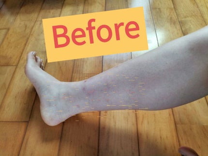 momo ෆ on LIPS 「ひなちゃんねる様の脚やせ25日目(多分)‼️ということで、ビフ..」(1枚目)