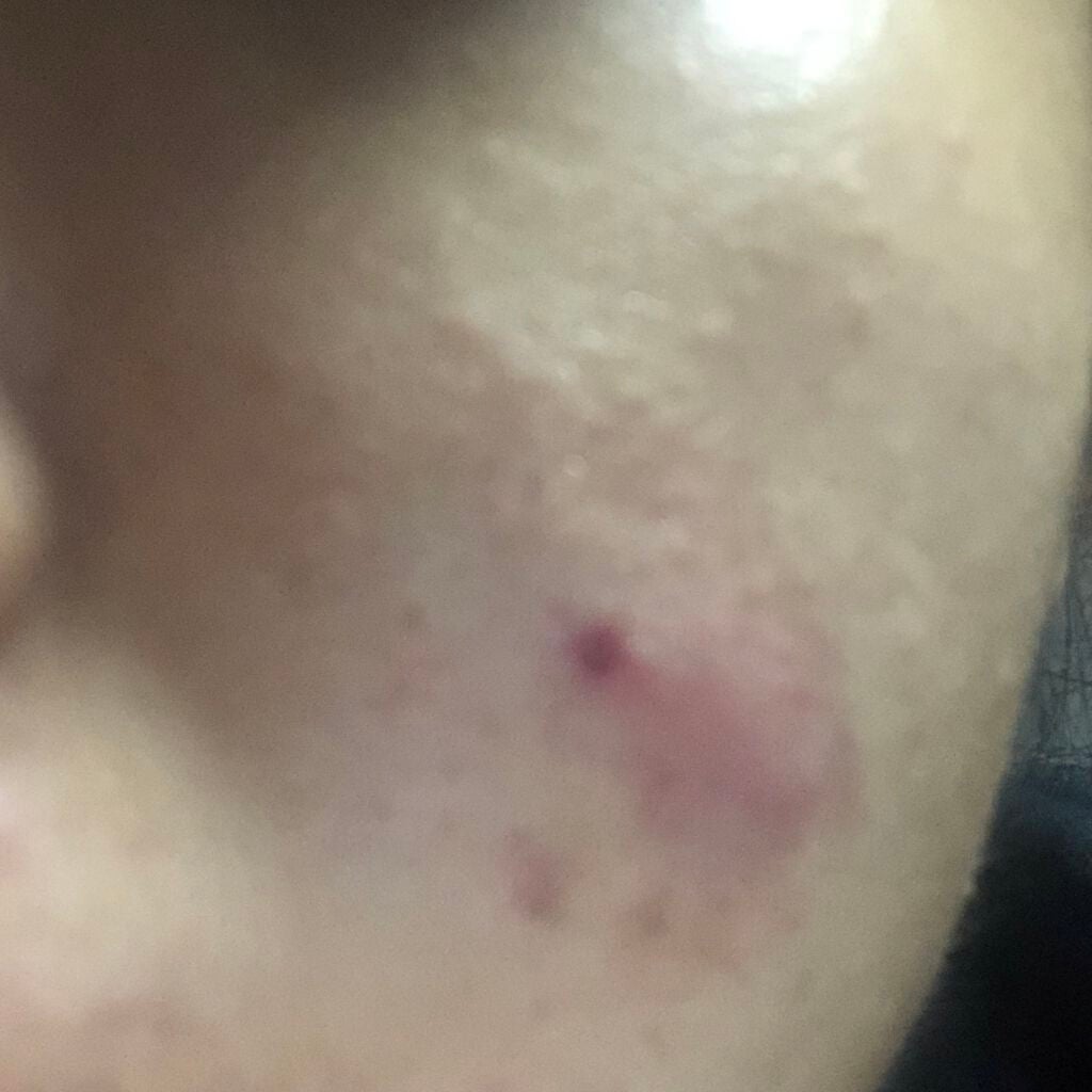 rin on LIPS 「【使った商品】アロエ92%ももぷり化粧水ももぷり潤いジェルクリ..」(2枚目)