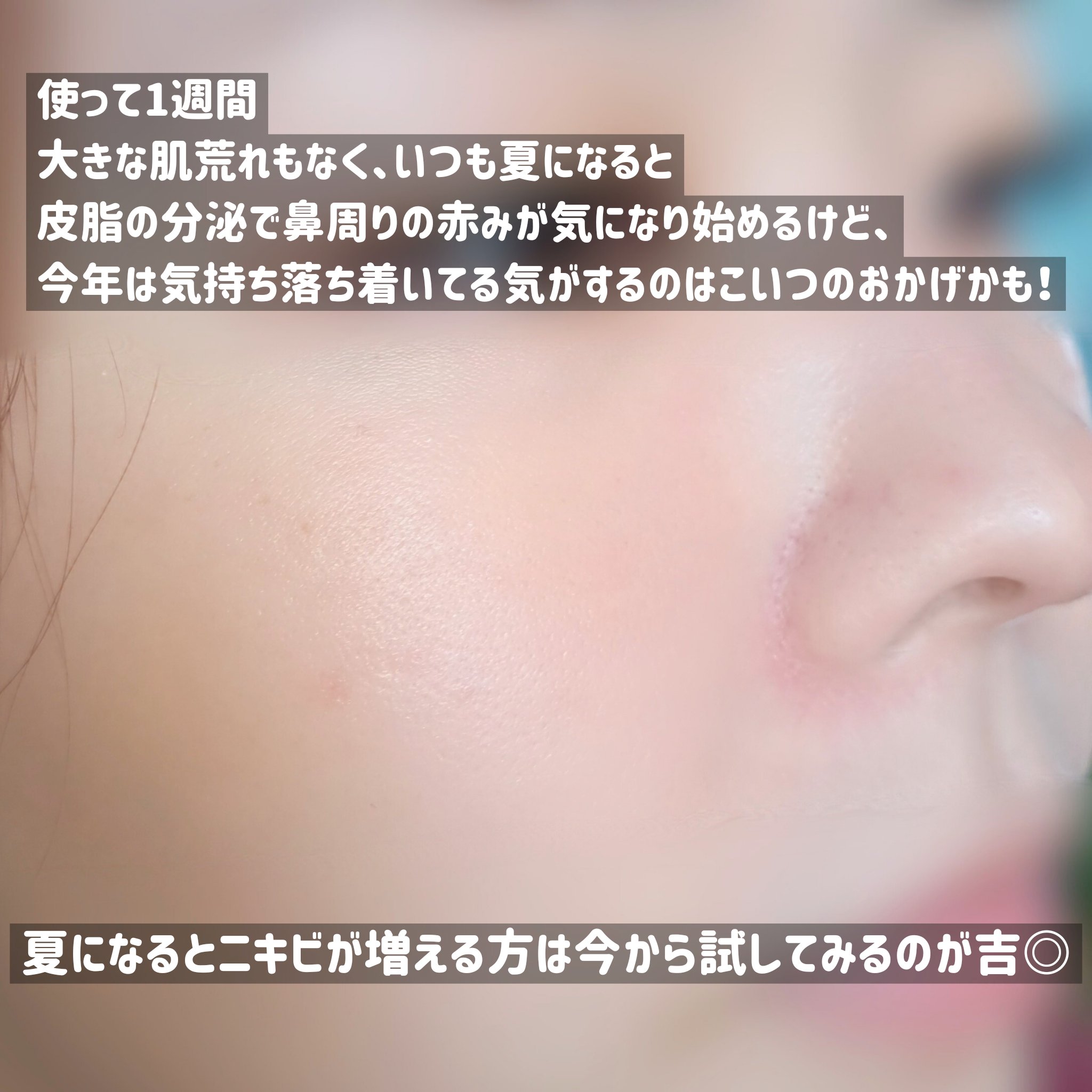 マジックティーツリーオイル/ブラン/フェイスオイルを使ったクチコミ（3枚目）