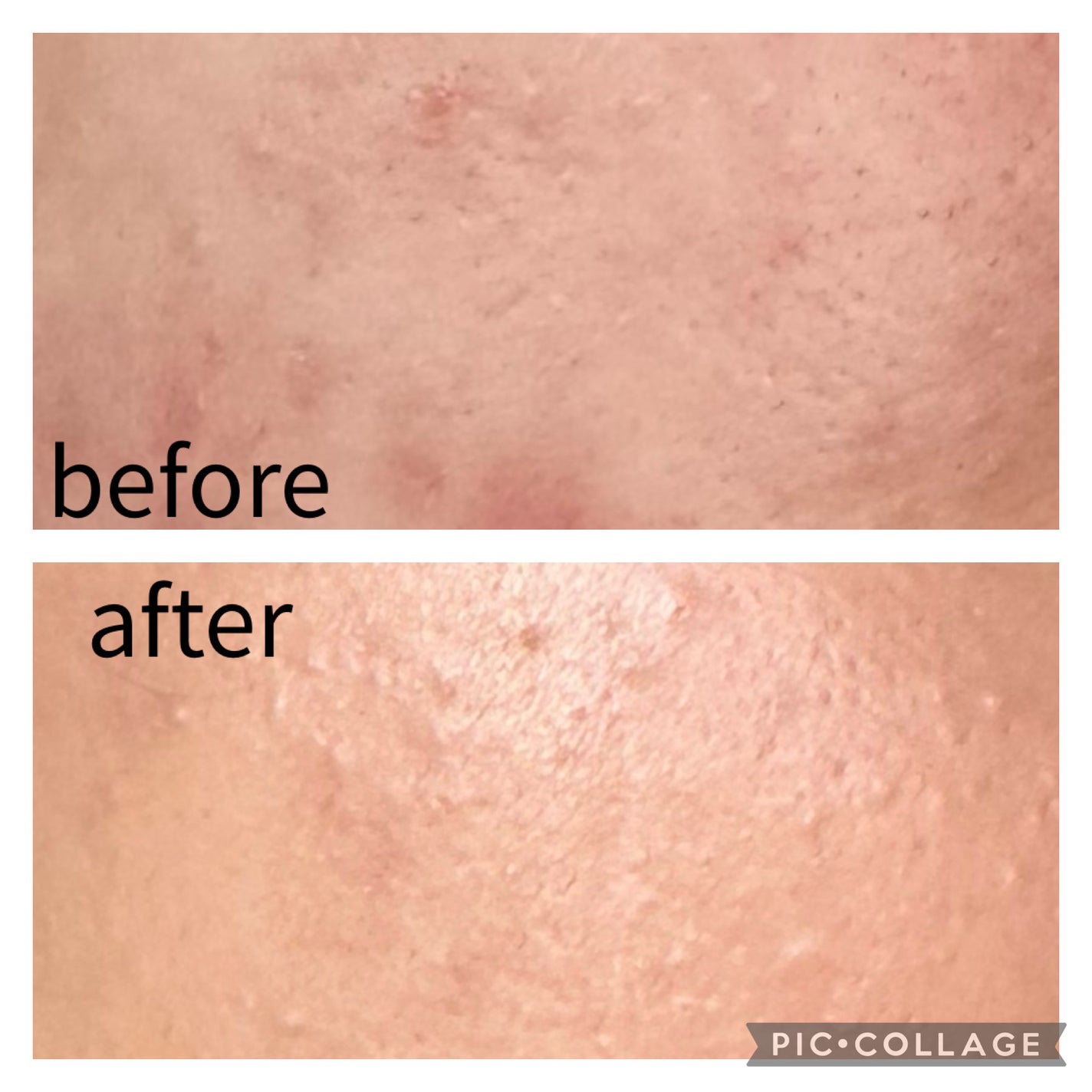 ロングラスティングチップコンシーラーフィックシングフィット/LUNA/リキッドコンシーラーを使ったクチコミ(4枚目)