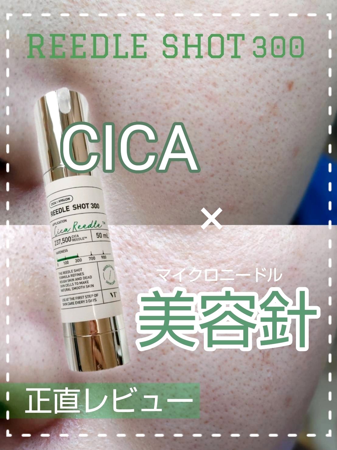 シカレチA エッセンス0.1/VT/美容液を使ったクチコミ（1枚目）