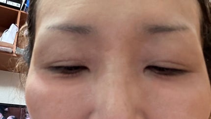 リシェ レッドトリック アイコンシーラー/Visée/パレットコンシーラーを使ったクチコミ(4枚目)