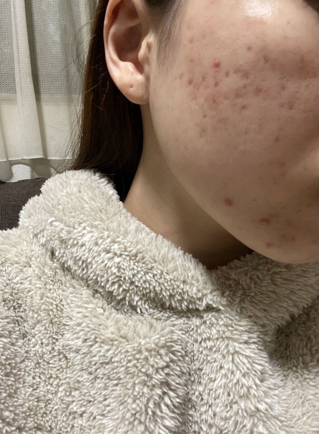 モイスチャー クリアソープ/アルージェ/洗顔石鹸を使ったクチコミ（1枚目）