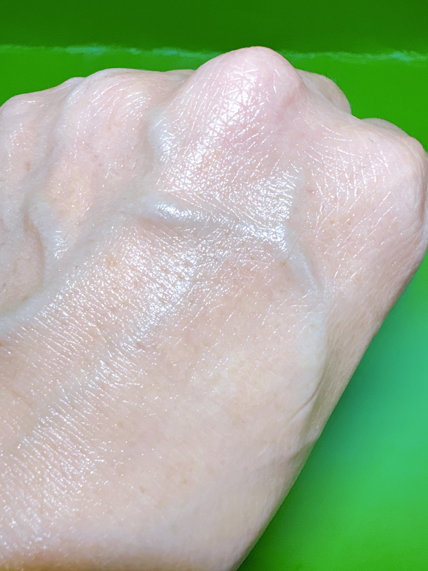 シカレチA エッセンス0.1/VT/美容液を使ったクチコミ(7枚目)