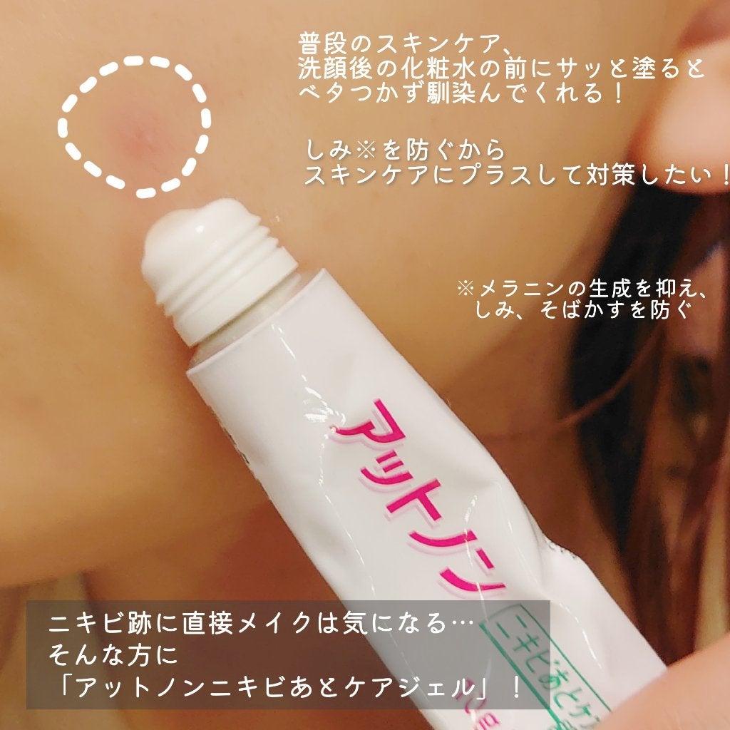 ニキビあとケアジェル/アットノン/その他スキンケアを使ったクチコミ(2枚目)