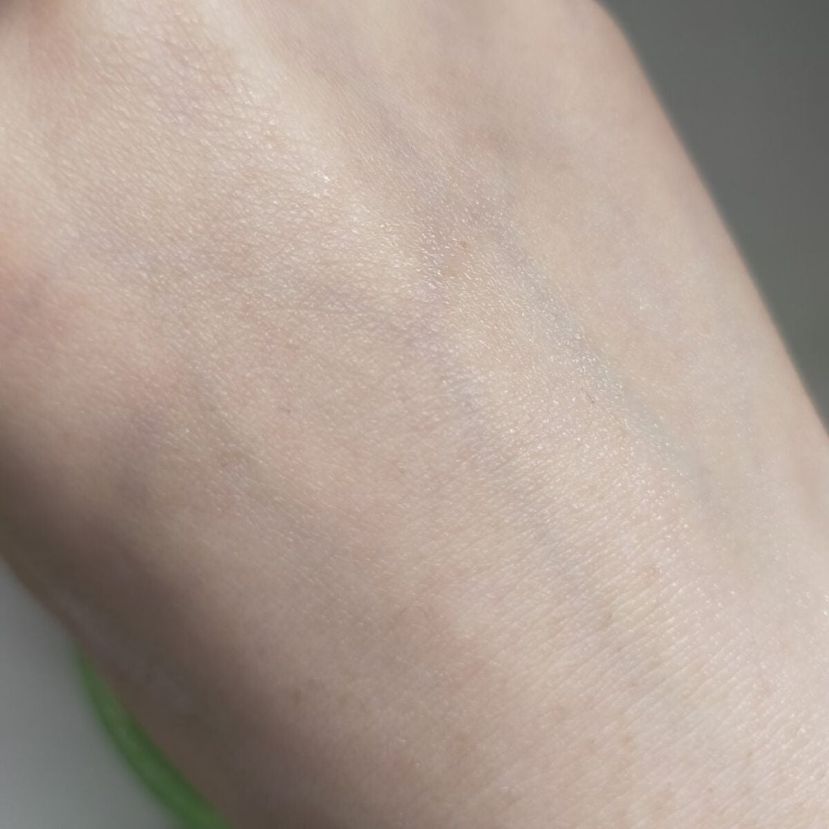 ティーツリーカーミングハイドロジェル/MEDIHEAL/ボディローションを使ったクチコミ(5枚目)