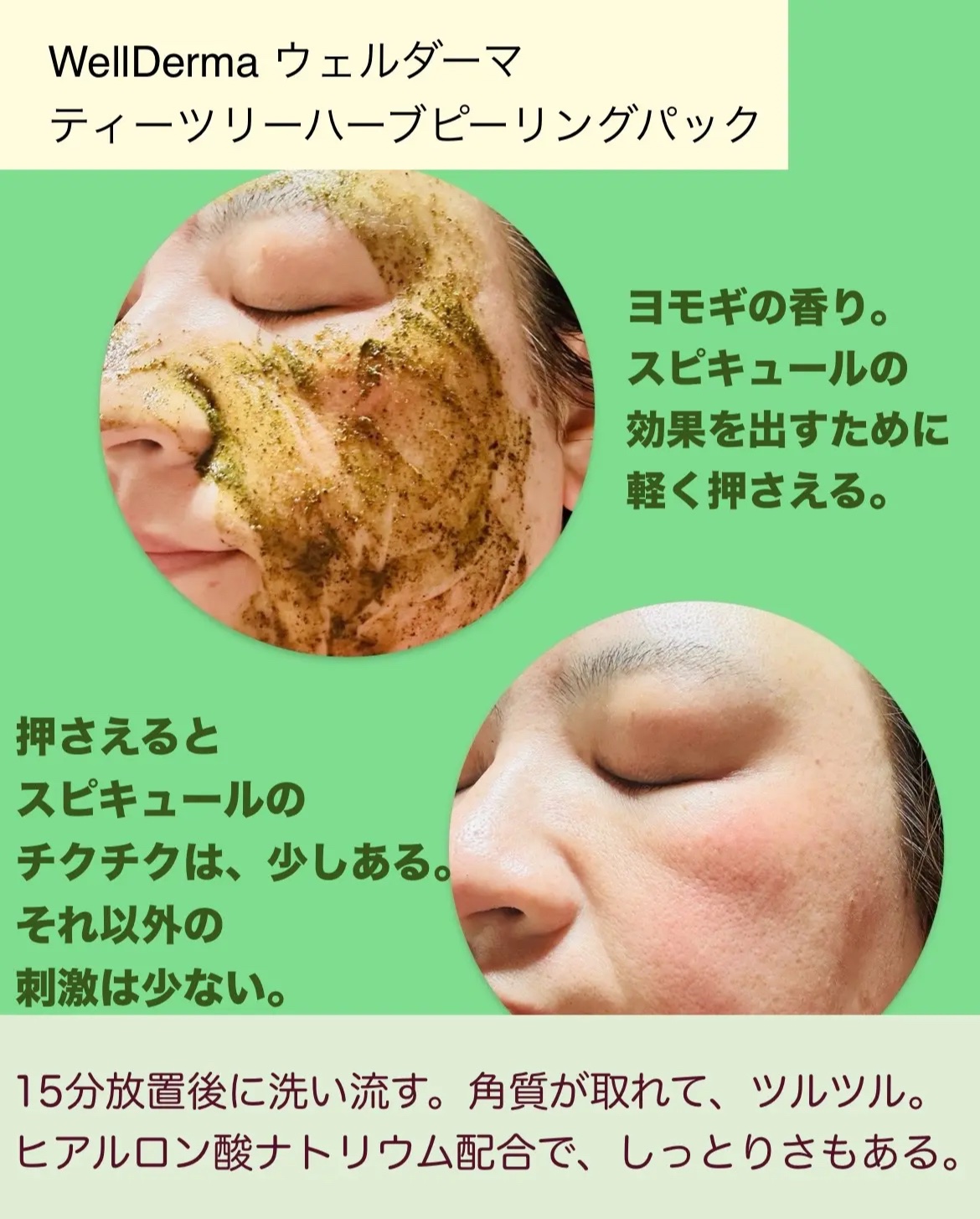 ティーツリーハーブピーリングパック/WellDerma/洗い流すパック・マスクを使ったクチコミ（3枚目）