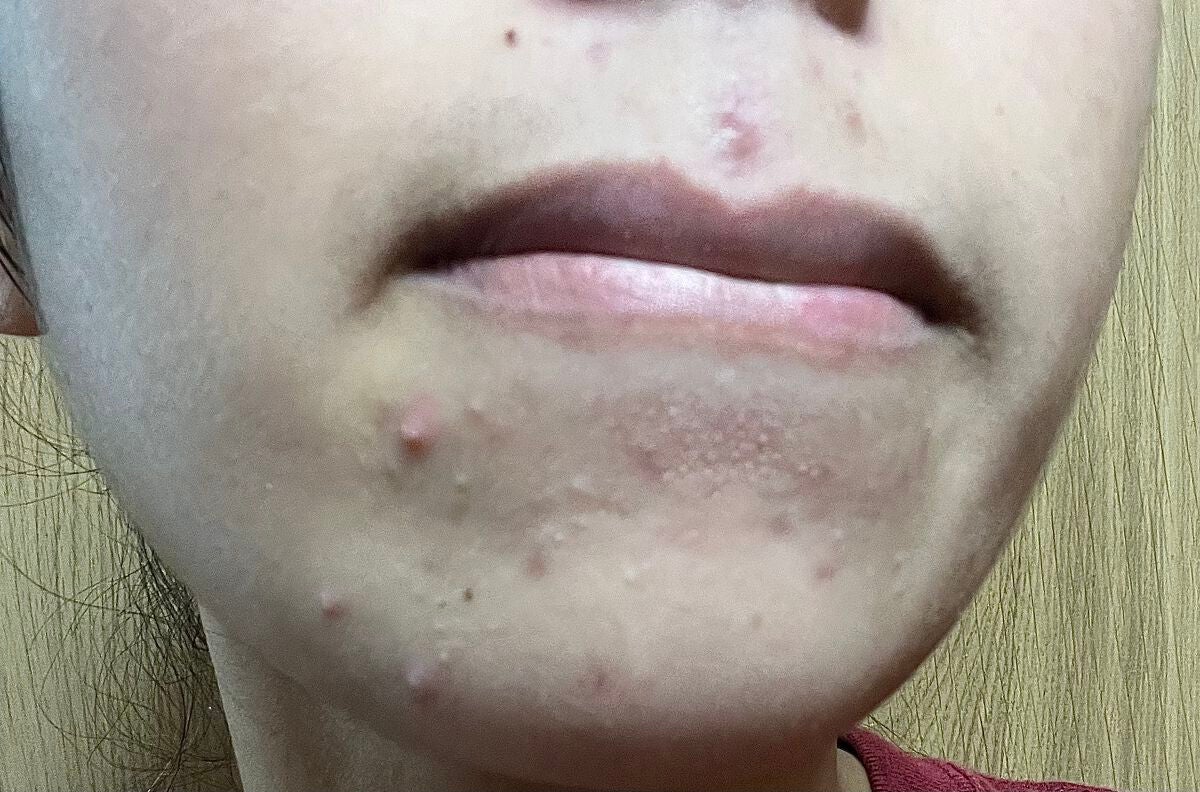 クレンジングオイルジェル/セルニュープラス/クレンジングジェルを使ったクチコミ(3枚目)