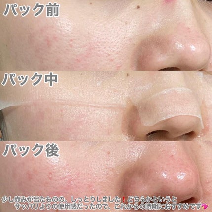 オールナチュラル マスクパックDK/allNATURAL/シートマスク・パックを使ったクチコミ(4枚目)