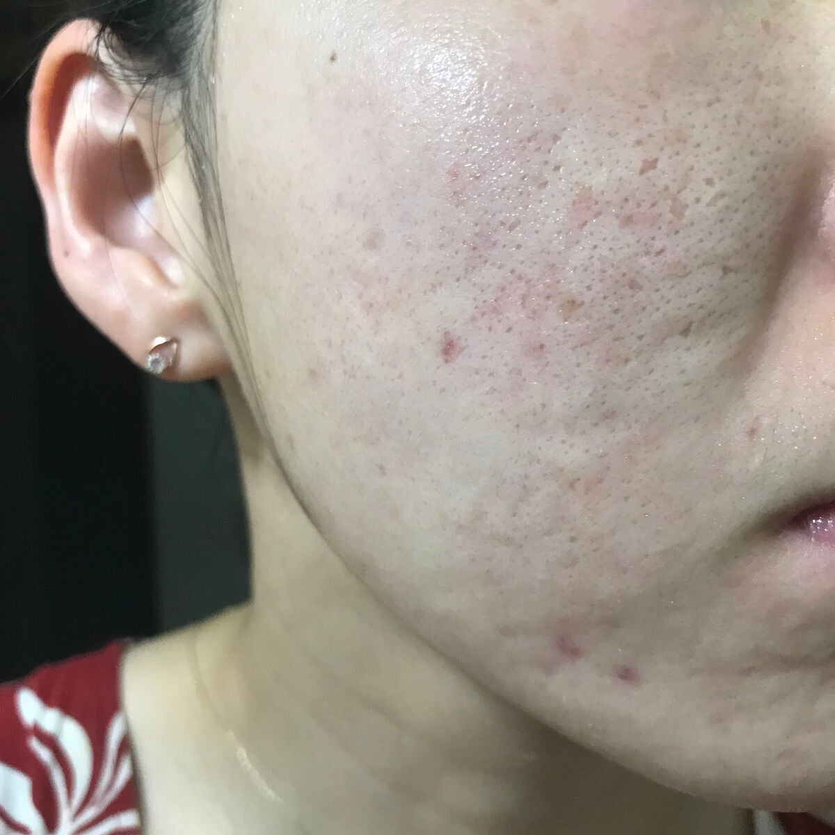 オリーブヤング ケアプラス/Olive Young/その他を使ったクチコミ(1枚目)