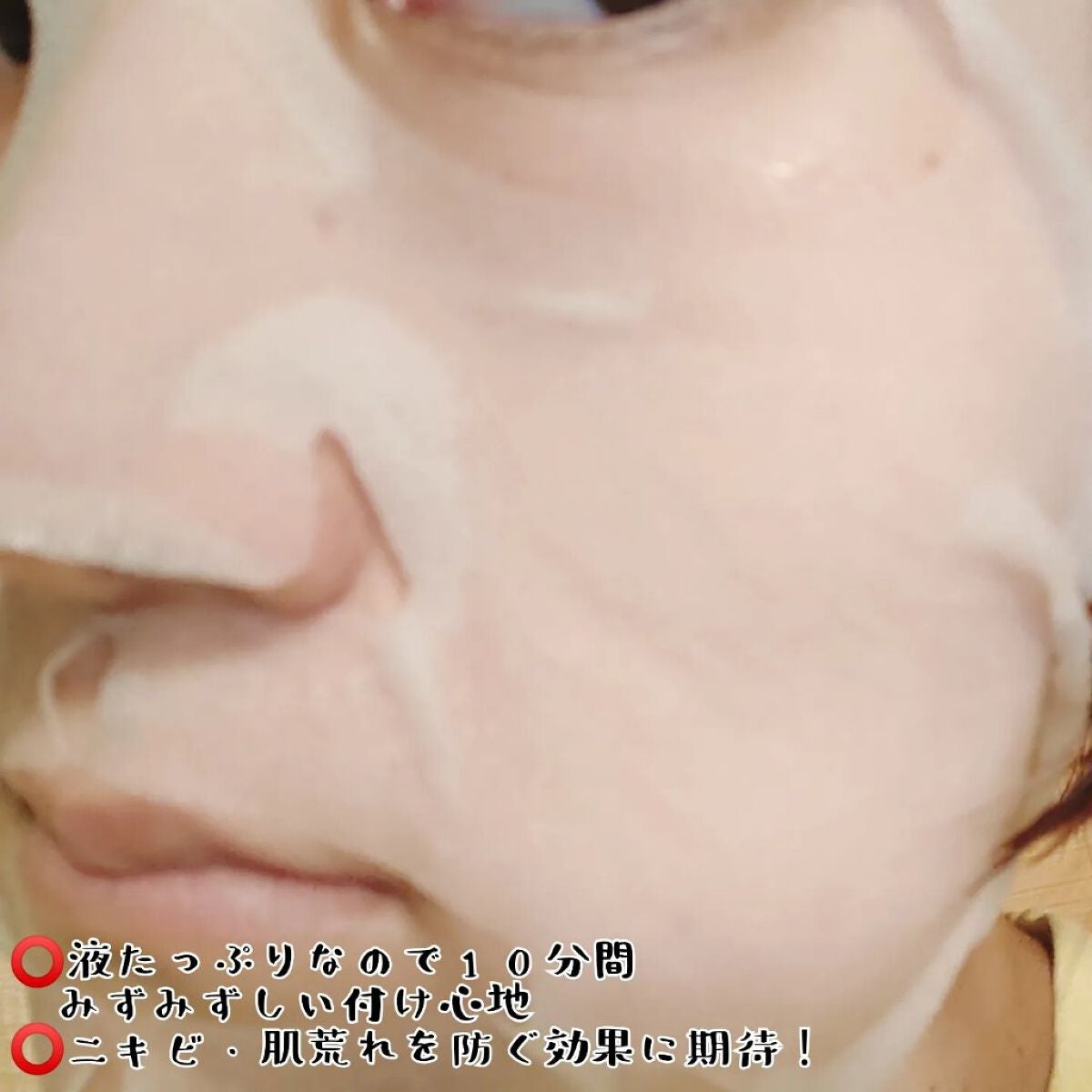 スキントラブルケア マスク/アルージェ/シートマスク・パックを使ったクチコミ(3枚目)