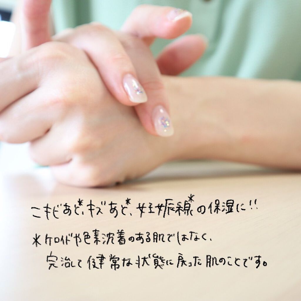 バイオイル/バイオイル/フェイスオイルを使ったクチコミ（3枚目）