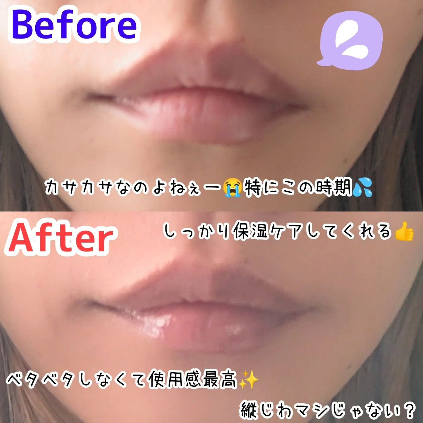 イリュン コラーゲンモイスチャーリップマスク/illuN/リップマスクを使ったクチコミ(2枚目)