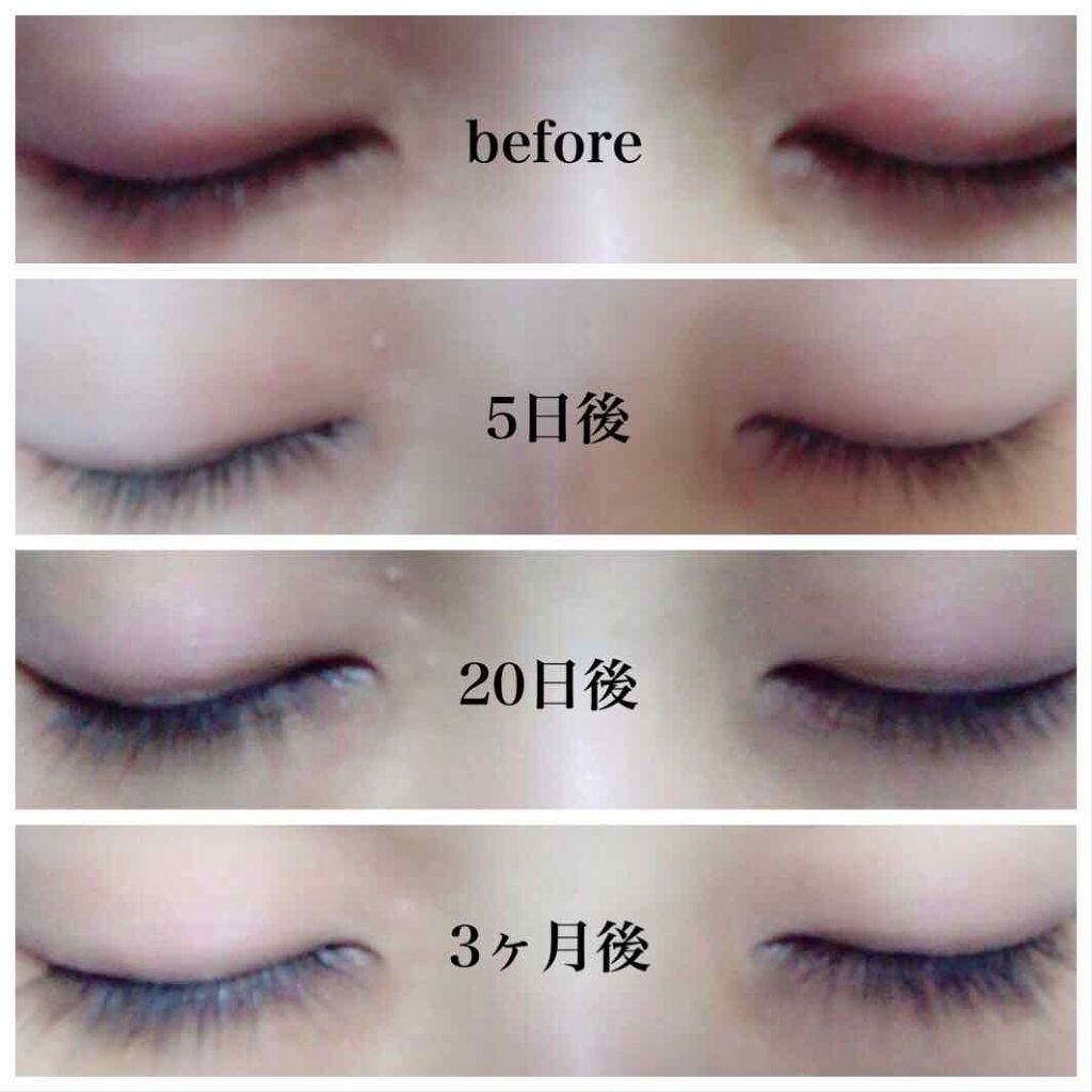 LULU on LIPS 「⚠️まぶたのアップ写真あります苦手な方は閲覧注意です!元々自ま..」(2枚目)