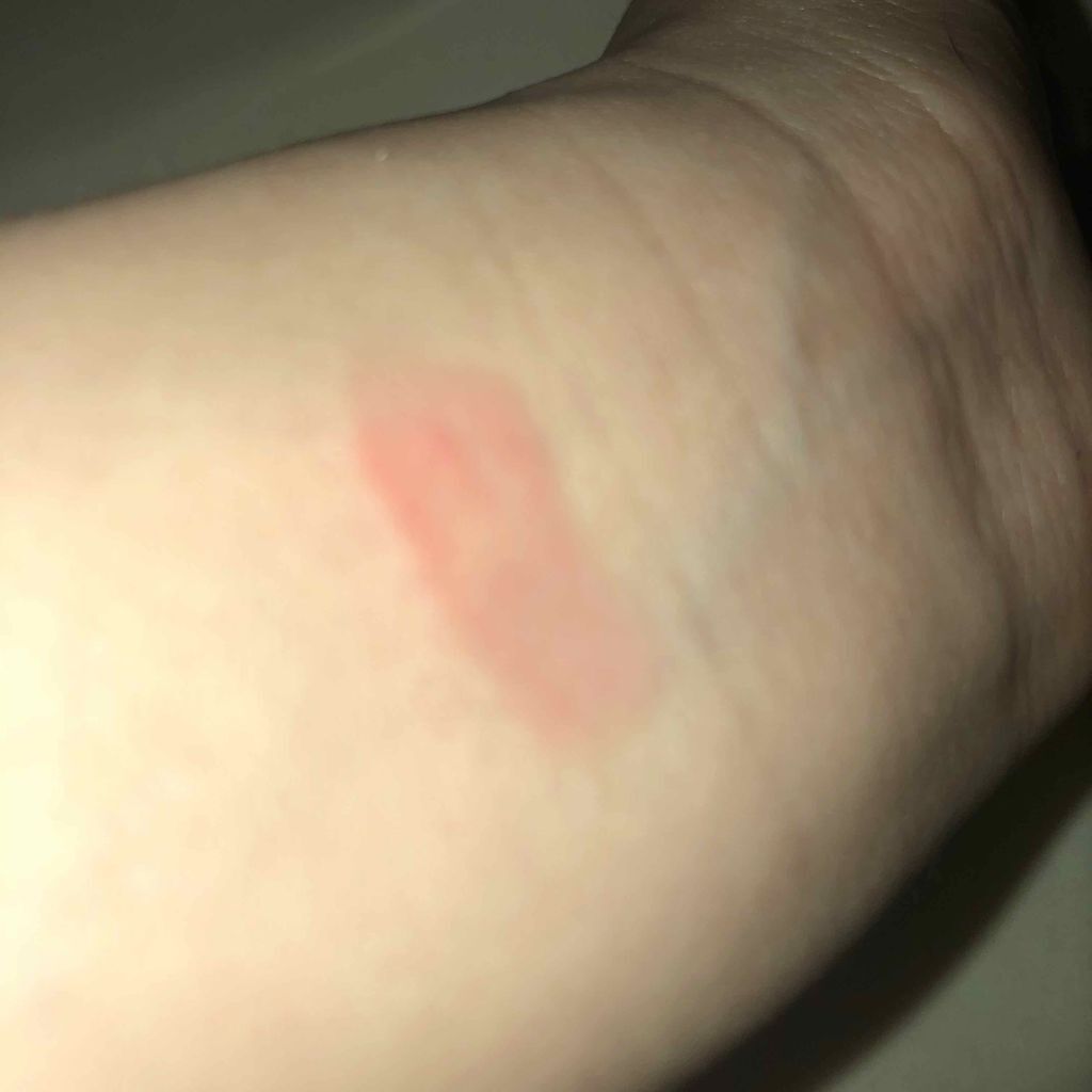 38°C / 99°F リップトリートメント (リップ美容液)/UZU BY FLOWFUSHI/リップケアを使ったクチコミ（2枚目）