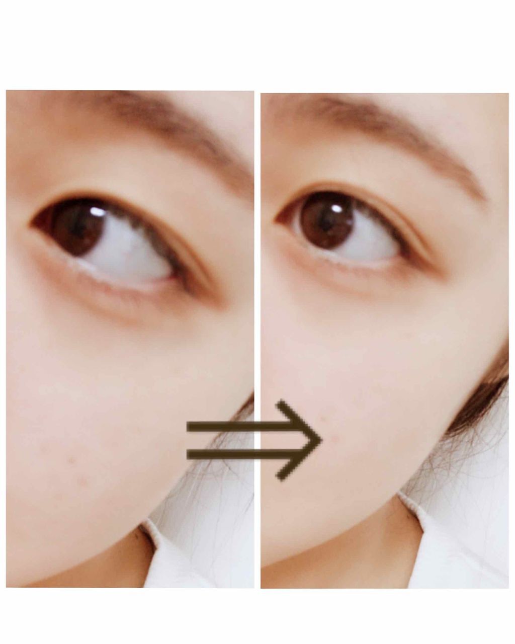 ワンダーアイリッドテープ Extra/D-UP/二重まぶた用アイテムを使ったクチコミ（2枚目）