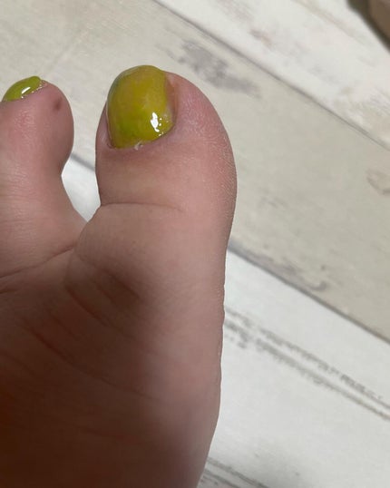 ぱすかる on LIPS 「ネイルを行う時はお風呂に入る前にネイルのボトルを冷凍庫で冷やし..」(7枚目)