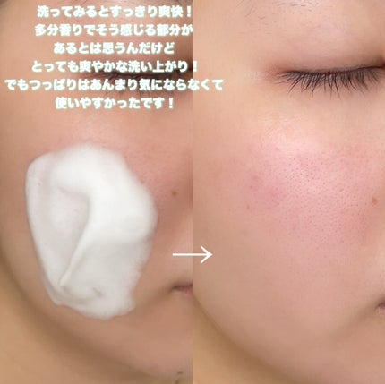 スイスキン 新芽ディープクレンジングフォーム/suiskin/洗顔フォームを使ったクチコミ(6枚目)