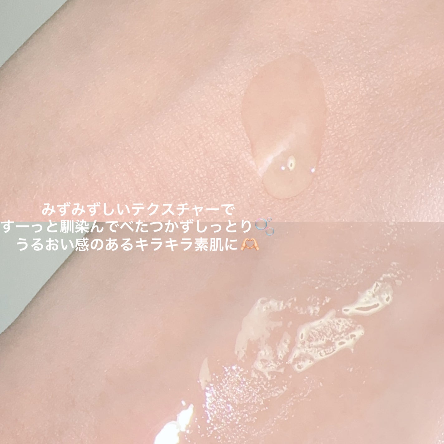 プロポリスレスキューアンプル 50ml/CNP Laboratory/美容液を使ったクチコミ(4枚目)