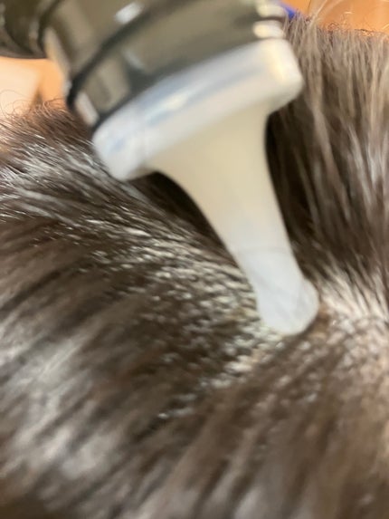 スカルプリッチ プロフェッショナル/日清食品/頭皮ローションを使ったクチコミ(5枚目)