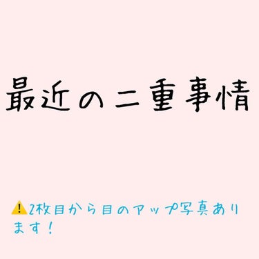 【最近の二重事情！👀💓】

最近、アイテープをはがしても、二重になるようになりましたっ！😆✨
クセが付いてきたのかな...？？嬉しいです〜((o(*>ω<*)o))

２回目の投稿でまたかよ！ってなると