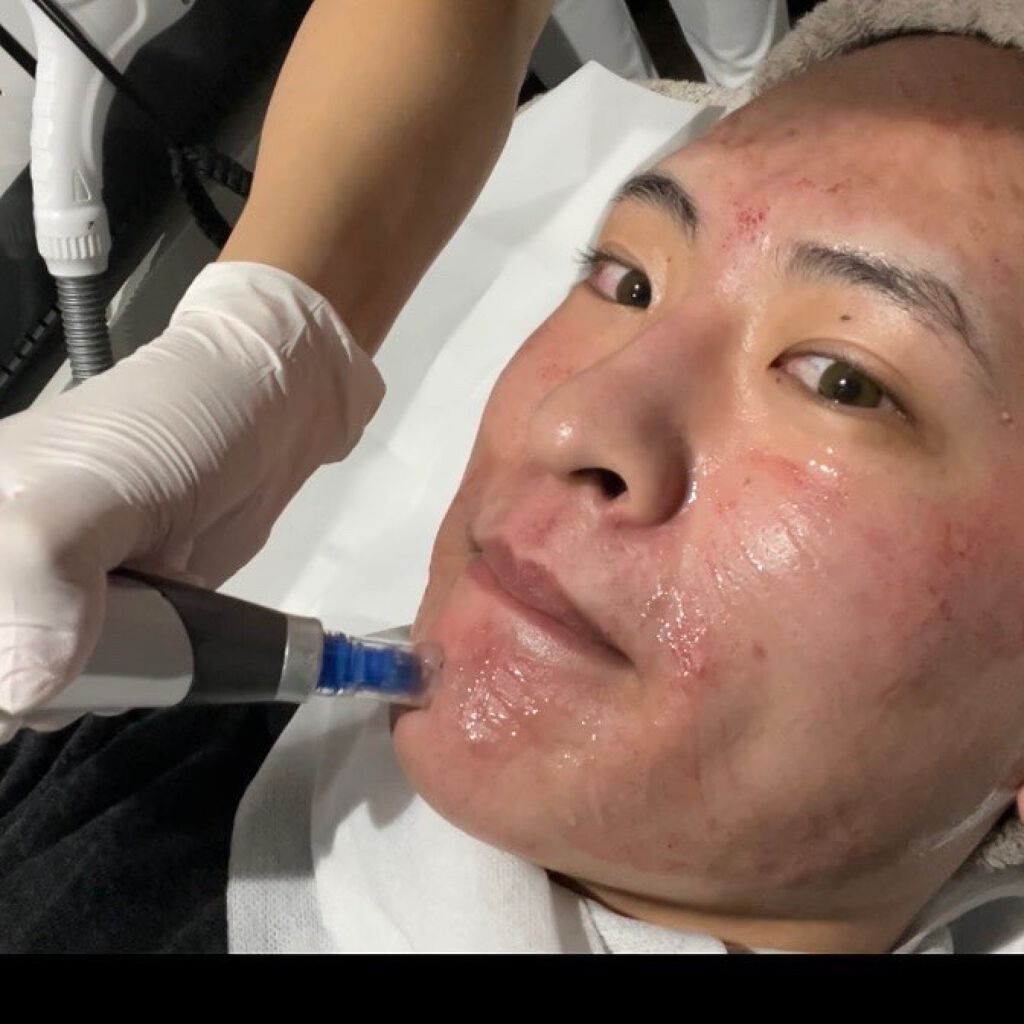 テラスキン/LINE REPAIR/美容液を使ったクチコミ（2枚目）