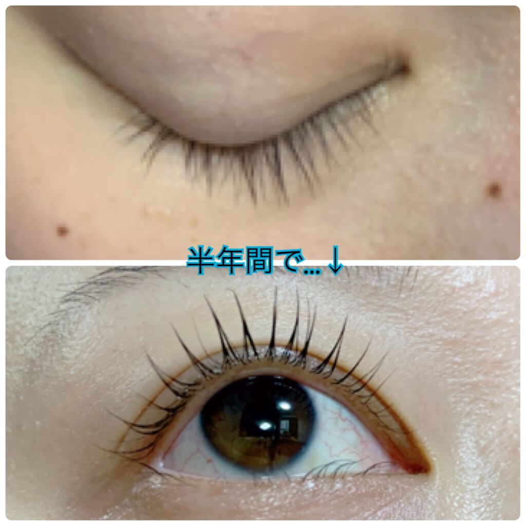 EMAKED（エマーキット）/水橋保寿堂製薬/まつげ美容液を使ったクチコミ（1枚目）