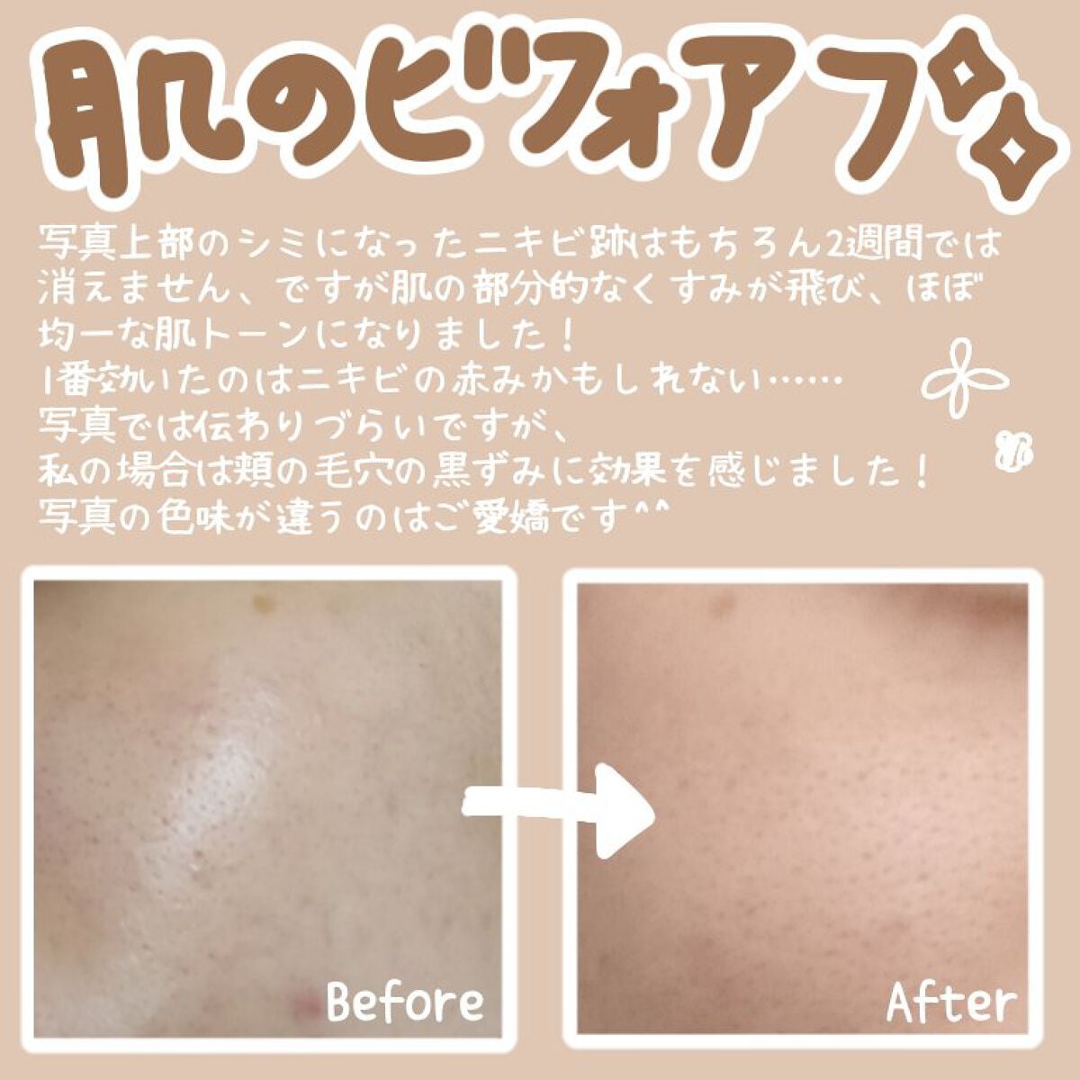 モイスチュアマイルドホワイト パーフェクトエッセンス/モイスチュアマイルド ホワイト/オールインワン化粧品を使ったクチコミ(3枚目)