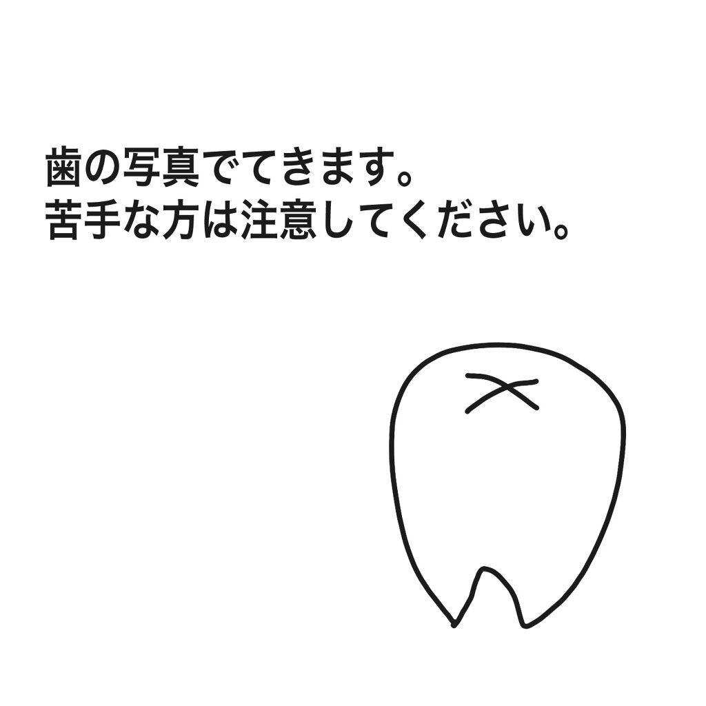 さくま on LIPS 「さくまと申します☻ついにオフィスホワイトニングが完了しましたの..」(3枚目)