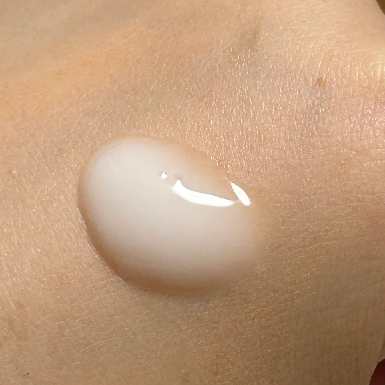 リードルショット300/VT/美容液を使ったクチコミ(2枚目)