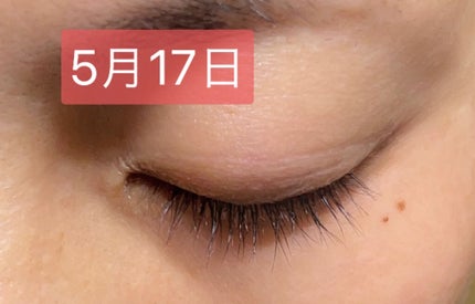 アヴァンセ ラッシュセラム EX(医薬部外品)/アヴァンセ/その他を使ったクチコミ(6枚目)