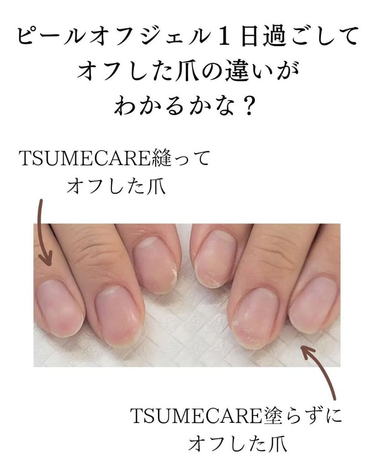 TSUMECARE/NailSalon mayunail/ネイルオイル・トリートメントを使ったクチコミ(8枚目)