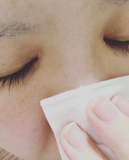 ル・マイルド化粧水/ル・マイルド/化粧水を使ったクチコミ(5枚目)