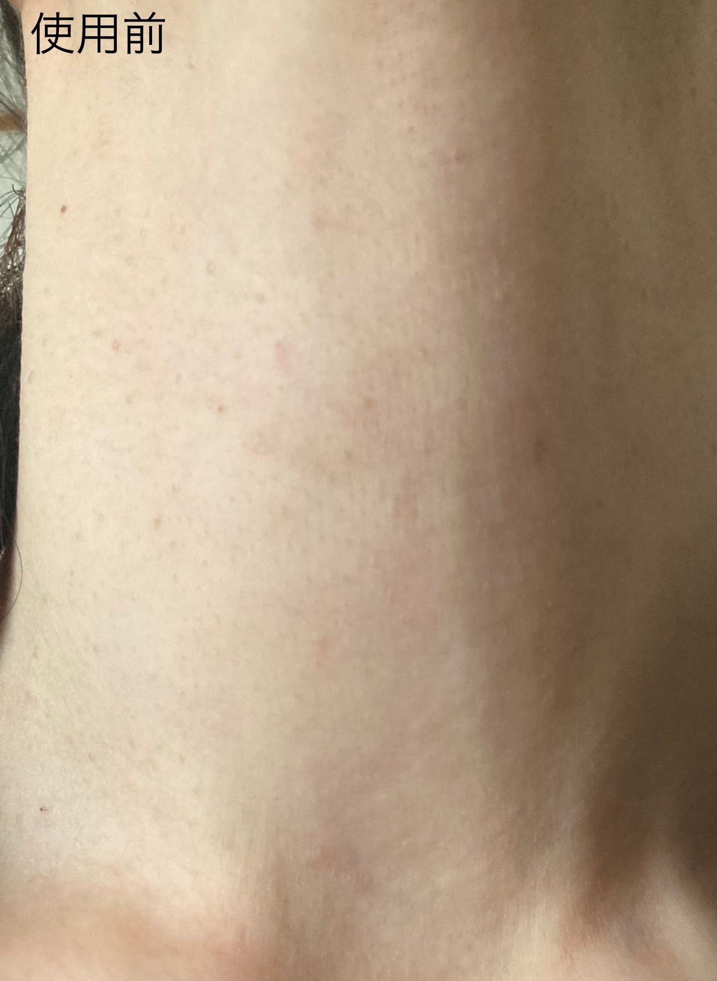 ハリーハリー 薬用おとなの美くびクリーム リッチ(医薬部外品)/ハリーハリー/ネック・デコルテケアを使ったクチコミ(3枚目)