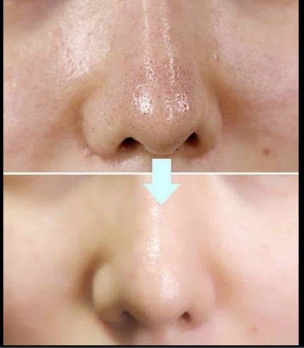 日本製ホワイトクリームD/DAISO/化粧下地を使ったクチコミ(2枚目)