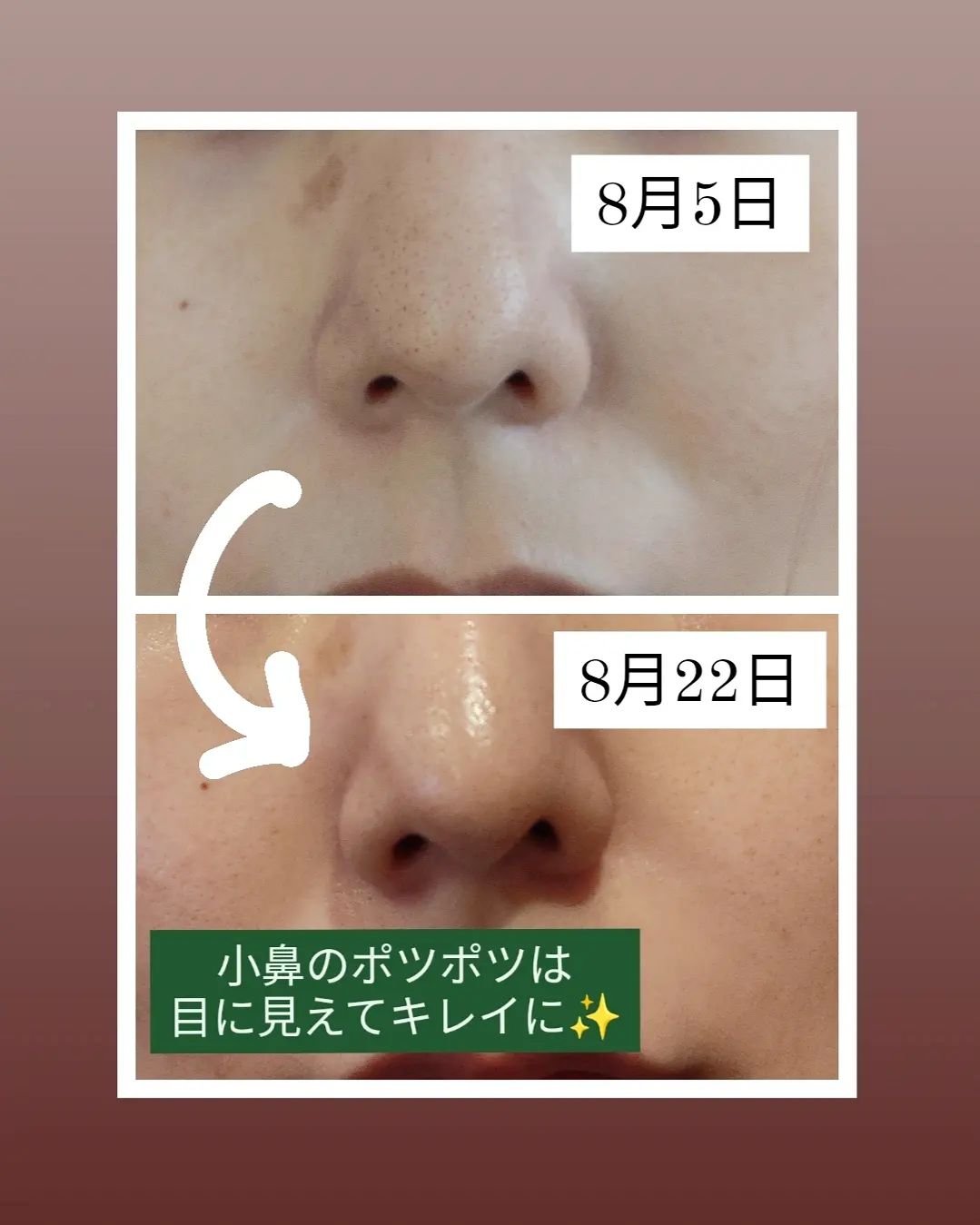 CICA デイリースージングマスク/VT/シートマスク・パックを使ったクチコミ（2枚目）