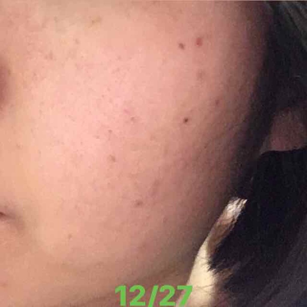 7 day Special Set プログラム4/b.glen/トライアルキットを使ったクチコミ(3枚目)