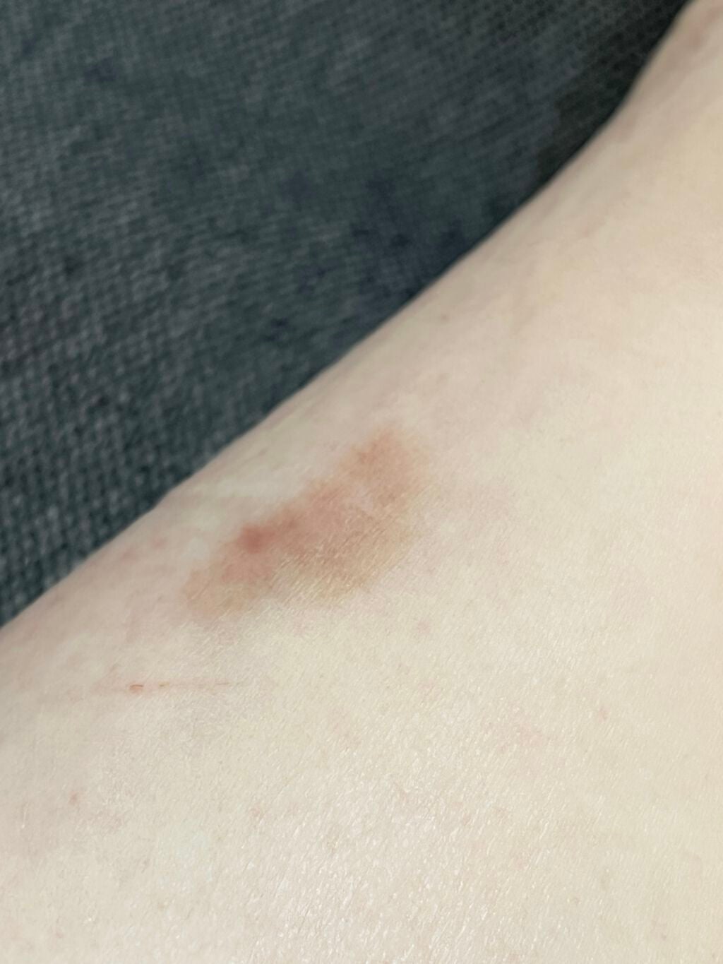 さいきa 保水治療ローション(医薬品)/Saiki/その他を使ったクチコミ(9枚目)