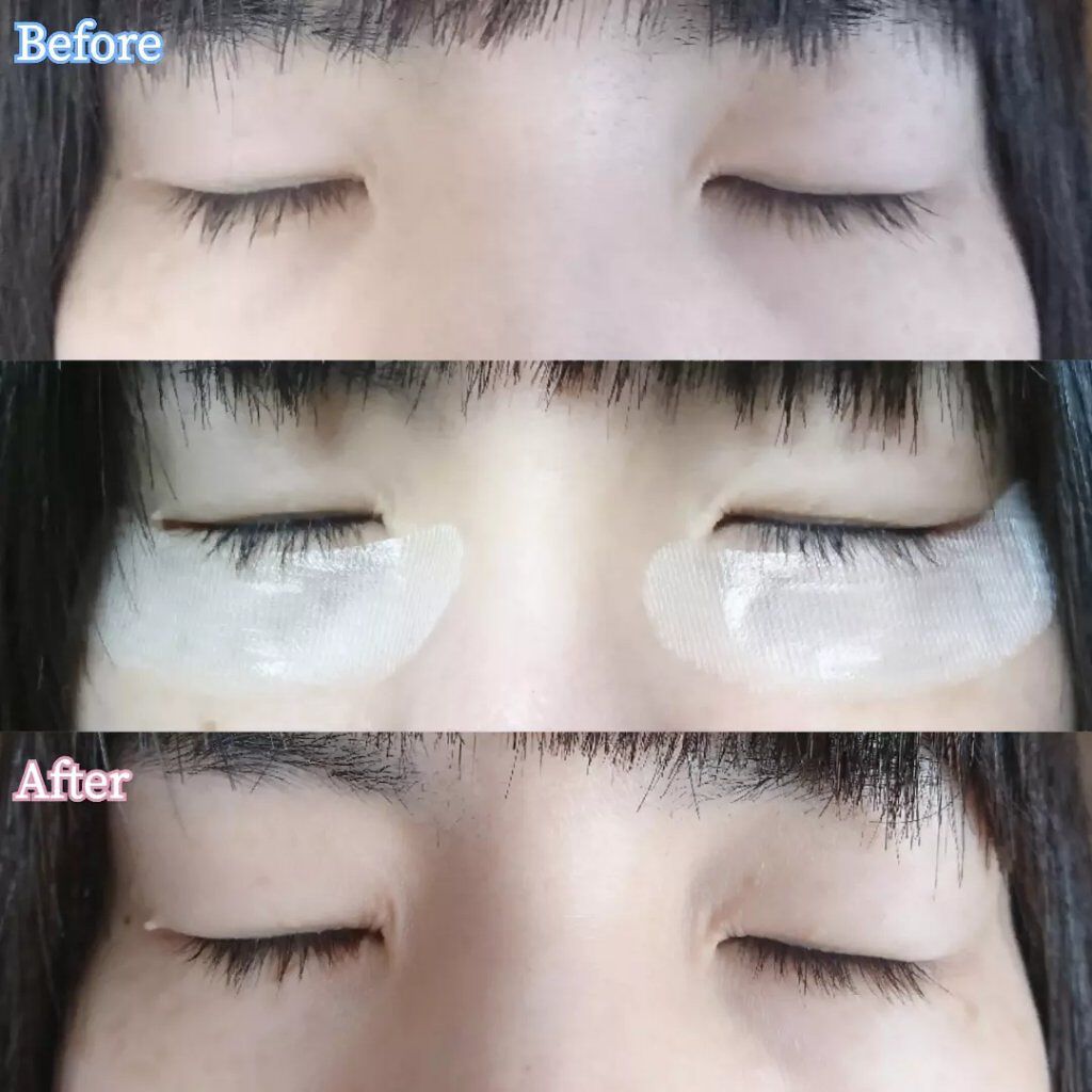 リクエス コンセントレート チャージ パッチ/クラブ/シートマスク・パックを使ったクチコミ(5枚目)