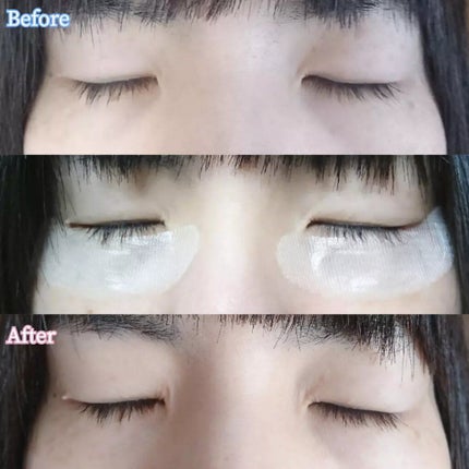 リクエス コンセントレート チャージ パッチ/クラブ/シートマスク・パックを使ったクチコミ(5枚目)