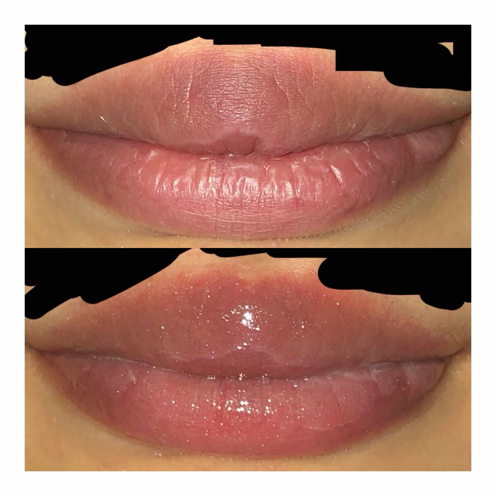 38°C / 99°F リップトリートメント (リップ美容液)/UZU BY FLOWFUSHI/リップケアを使ったクチコミ（2枚目）