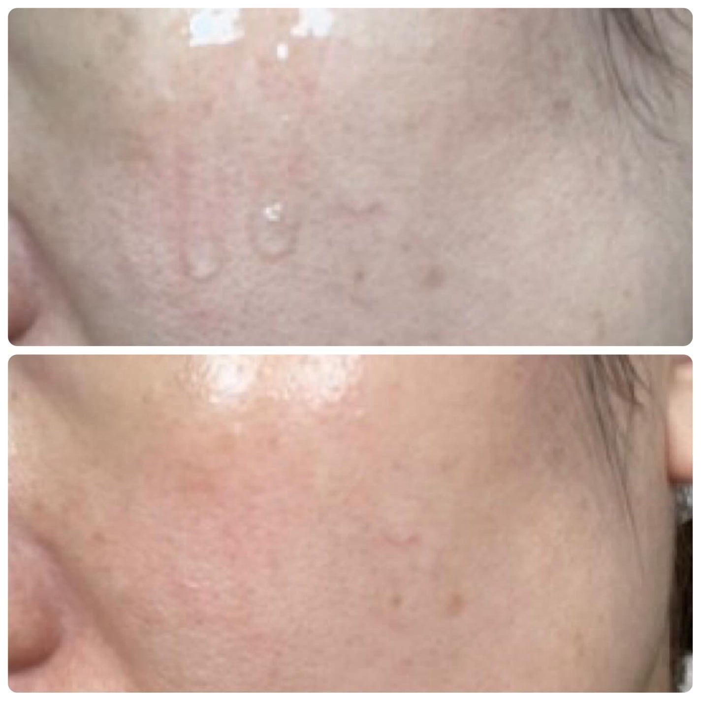 ピンクアロエビタトナー/APRILSKIN/化粧水を使ったクチコミ(9枚目)