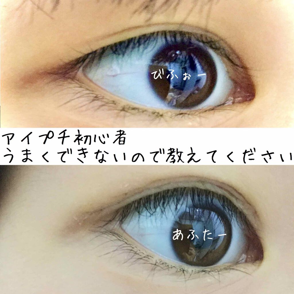 こんにちは😃ちひろです！
私事なのですが、実は私奥二重なんです！しかも激重！まぶたの脂肪にいつも悩んでいるくらいです。。。

今回アイプチ初心者の私がやってみたものはダイソーのアイテープで固定してからアイトークで食い込ませると言うものです